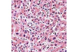 ALP antibody immunohistochemistry analysis in formalin fixed and paraffin embedded human liver tissue.
