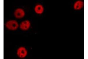 ABIN6274305 staining Hela cells by IF/ICC. (SSBP2 antibody  (N-Term))