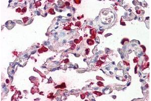 Image no. 2 for anti-Surfactant Protein B (SFTPB) (AA 194-243) antibody (ABIN1493901) (SFTPB antibody  (AA 194-243))