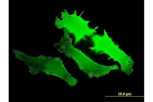 Immunofluorescence of monoclonal antibody to GUCY2D on HeLa cell.