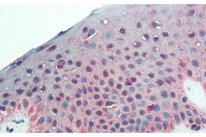 Detection of CSPG4 in Human Skin Tissue using Monoclonal Antibody to Chondroitin Sulfate Proteoglycan 4 (CSPG4) (NG2 antibody  (AA 559-776))