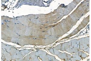 ABIN7093792 and ABIN7097835 at 1/100 staining Mouse skin tissue by IHC-P. (PDLIM3 antibody  (Internal Region))