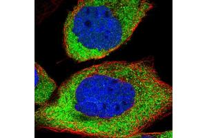 Immunofluorescent staining of human cell line A-431 shows localization to cytosol.