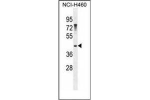 Western blot analysis of GAS1 Antibody (N-term) in NCI-H460 cell line lysates (35ug/lane). (GAS1 antibody  (N-Term))