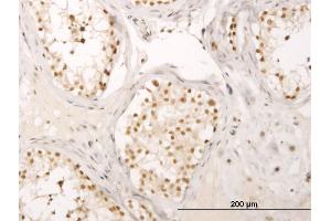 Immunoperoxidase of monoclonal antibody to CRSP6 on formalin-fixed paraffin-embedded human testis. (MED17 antibody  (AA 551-651))