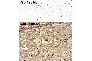 Immunohistochemistry (IHC) image for anti-Epidermal Growth Factor Receptor (EGFR) (C-Term) antibody (ABIN6254171) (EGFR antibody  (C-Term))
