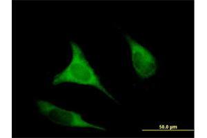 Immunofluorescence of purified MaxPab antibody to EIF2B3 on HeLa cell. (EIF2B3 antibody  (AA 1-452))