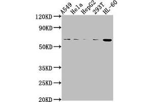 Western Blotting (WB) image for anti-Mdm2, p53 E3 Ubiquitin Protein Ligase Homolog (Mouse) (MDM2) (AA 374-391) antibody (ABIN7139815)