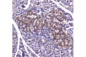 IHC analysis of IDE using anti-IDE antibody . (IDE antibody  (AA 485-756))