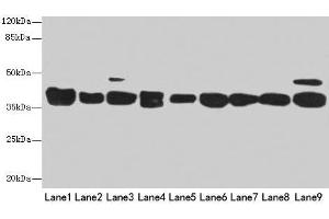 Western blot All lanes: DNAJB1 antibody at 3 μg/mL Lane 1: Mouse spleen tissue Lane 2: Colo320 whole cell lysate Lane 3: Hela whole cell lysate Lane 4: LO2 whole cell lysate Lane 5: HepG2 whole cell lysate Lane 6: HT29 whole cell lysate Lane 7: A549 whole cell lysate Lane 8: Jurkat whole cell lysate Lane 9: MCF-7 whole cell lysate Secondary Goat polyclonal to rabbit IgG at 1/10000 dilution Predicted band size: 39, 28 kDa Observed band size: 39 kDa (DNAJB1 antibody  (AA 1-340))
