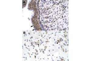 Immunohistochemical staining (Formalin-fixed paraffin-embedded sections) of human spermatophore (A) and human brain (B) with GTF2F2 polyclonal antibody  at 4-8 ug/mL working concentration. (GTF2F2 antibody  (Internal Region))