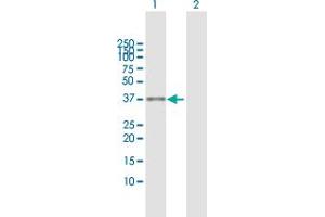 Western Blotting (WB) image for anti-Aspartoacylase (ASPA) (AA 1-313) antibody (ABIN513550)