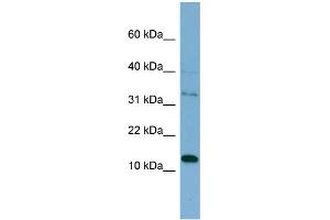 WB Suggested Anti-PHLDA2  Antibody Titration: 0. (PHLDA2 antibody  (Middle Region))
