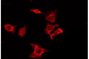 ABIN6275980 staining 293T by IF/ICC. (CNR1 antibody  (N-Term))