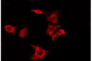 ABIN6275980 staining 293T by IF/ICC. (CNR1 antibody  (N-Term))