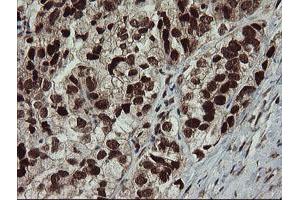 Image no. 10 for anti-Replication Factor C (Activator 1) 2, 40kDa (RFC2) (AA 1-234) antibody (ABIN1490617)