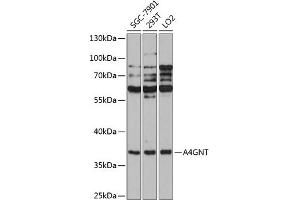 Western blot analysis of extracts of various cell lines, using GNT antibody  at 1:1000 dilution. (A4GNT antibody  (AA 1-340))