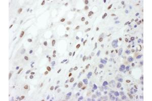 Immunohistochemistry (IHC) image for anti-Lamin A/C (LMNA) (AA 400-450) antibody (ABIN7455219)
