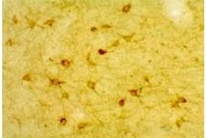 Low magnification IHC image of neurons in rat cortex.