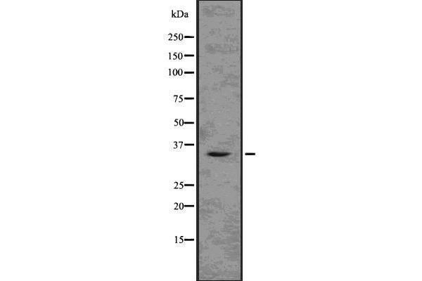 TMX2 anticorps  (N-Term)
