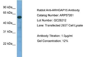 WB Suggested Anti-ARHGAP15  Antibody Titration: 0. (ARHGAP15 antibody  (Middle Region))