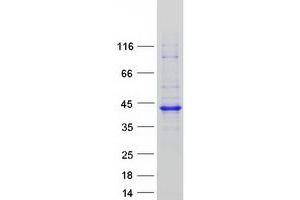 Validation with Western Blot (RP2 Protein (Myc-DYKDDDDK Tag))