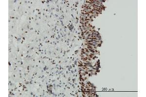 Immunoperoxidase of monoclonal antibody to EWSR1 on formalin-fixed paraffin-embedded human urinary bladder. (EWSR1 antibody  (AA 358-453))