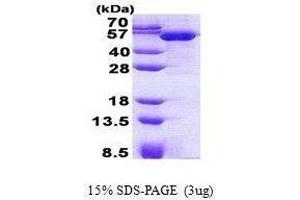 Figure annotation denotes ug of protein loaded and % gel used. (TBCEL Protein)