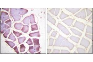 Immunohistochemistry analysis of paraffin-embedded human skeletal muscle, using S6 Ribosomal Protein (Phospho-Ser240) Antibody. (RPS6 antibody  (pSer240))
