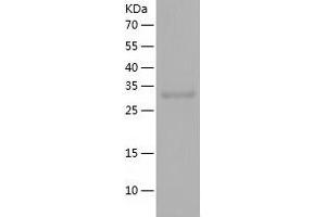 Western Blotting (WB) image for Ubiquitin-Like Domain Containing CTD Phosphatase 1 (UBLCP1) (AA 1-318) protein (His tag) (ABIN7125640) (UBLCP1 Protein (AA 1-318) (His tag))