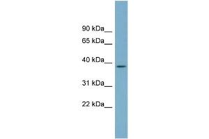 WB Suggested Anti-SDSL Antibody Titration:  0.