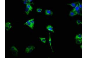 Immunofluorescence staining of HepG2 cells with ABIN7154406 at 1:466, counter-stained with DAPI. (CSF2RA antibody  (AA 23-320))