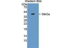 Figure. (Neurocan antibody  (AA 960-1225))
