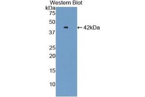Detection of Recombinant VTCN1, Human using Polyclonal Antibody to V-Set Domain Containing T-Cell Activation Inhibitor 1 (VTCN1) (VTCN1 antibody  (AA 153-241))
