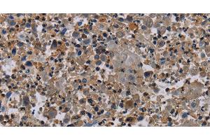 Immunohistochemistry (Paraffin-embedded Sections) (IHC (p)) image for anti-Poliovirus Receptor-Related 4 (PVRL4) antibody (ABIN7237516)