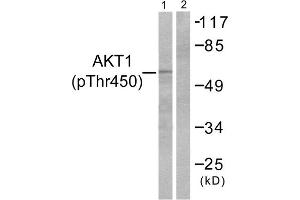 Western blot analysis of extracts from NIH/3T3 cells, treated with PDGF (50ng/ml, 20mins), using Akt (Phospho-Thr450) antibody. (AKT1 antibody  (pThr450))
