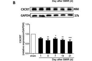 The CXCR7 and PI3K/Akt signaling pathways are involved in CPSP in the dorsal horn of the spinal cord. (GAPDH antibody)