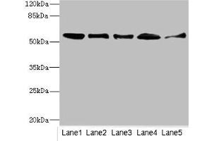 Western blot All lanes: GLYCTKantibody at 5. (GLYCTK antibody  (AA 284-523))
