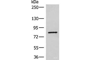 Western blot analysis of Human hepatocellular carcinoma tissue lysate using SLC26A3 Polyclonal Antibody at dilution of 1:250 (SLC26A3 antibody)