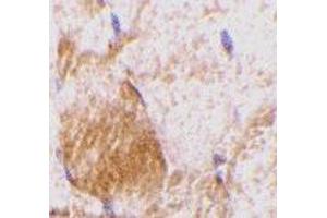 Immunohistochemistry of IL-31 in rat skeletal muscle tissue with IL-31 antibody at 10 μg/ml. (IL-31 antibody  (N-Term))