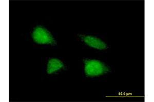 Immunofluorescence of purified MaxPab antibody to C19orf43 on HeLa cell. (C19orf43 antibody  (AA 1-176))
