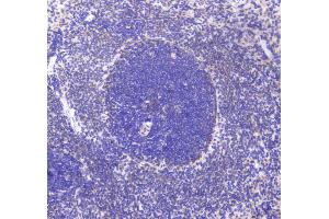 IHC analysis of CD80 using anti-CD80 antibody . (CD80 antibody  (AA 35-244))