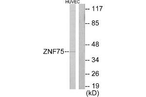 Western blot analysis of extracts from HUVEC cells, using ZNF75 antibody. (ZNF75 antibody  (C-Term))