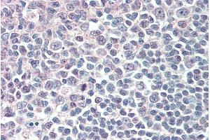 Image no. 2 for anti-Interferon Regulatory Factor 8 (IRF8) antibody (ABIN5868811) (IRF8 antibody)