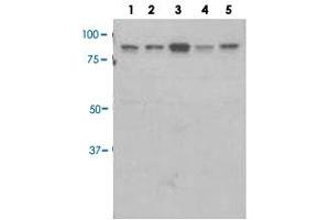 Western blot analysis of Lane 1: 293, Lane 2: HeLa, Lane 3: A549, Lane 4: H460, Lane 5: H1703 with CARS polyclonal antibody (PAB28563) at 1:10000 dilution. (CARS antibody)
