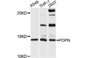 Western blot analysis of extracts of various cell lines, using PDPN antibody (ABIN5974310) at 1/1000 dilution. (Podoplanin antibody)