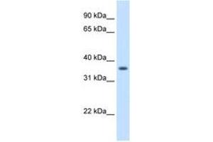 Image no. 1 for anti-Aldo-Keto Reductase Family 1, Member B10 (Aldose Reductase) (AKR1B10) (AA 51-100) antibody (ABIN204999) (AKR1B10 antibody  (AA 51-100))