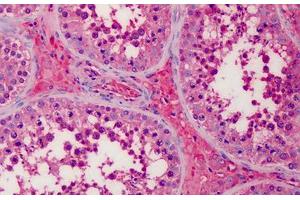 Human Testis, Leydig Cells: Formalin-Fixed, Paraffin-Embedded (FFPE) (APOA2 antibody)