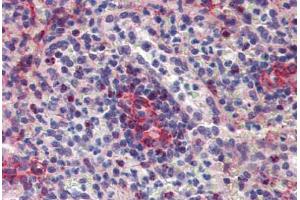 Spleen, Human: Formalin-Fixed, Paraffin-Embedded (FFPE) (Septin 11 antibody  (N-Term))