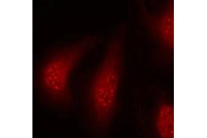 Immunofluorescence staining of methanol-fixed Hela cells using p90RSK(Phospho-Thr348) Antibody. (RPS6KA1 antibody  (pThr348))